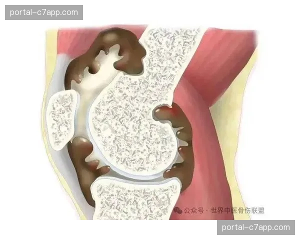 李文淏膝踝关节反复积液 中国速滑队伤病预防措施